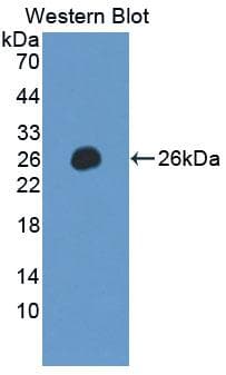 LILRB2 / ILT4 Antibody (aa53-255)