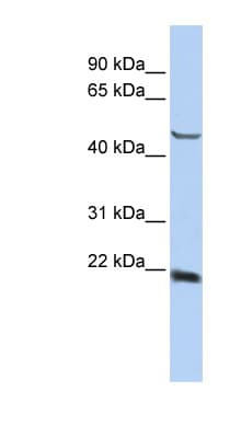 Polyclonal Rabbit anti-Human SSX4 Antibody (aa108-157, IHC, WB)