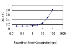 MUTYH / MYH Antibody (clone 4D10)