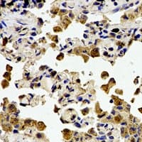 Polyclonal Rabbit anti-Human CSTA / Cystatin A Antibody (Internal, IHC, IF, WB)