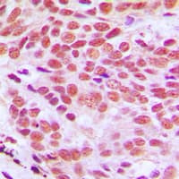 Polyclonal Rabbit anti-Human Histone H2B Antibody (N-Terminus, IHC, IF, WB)
