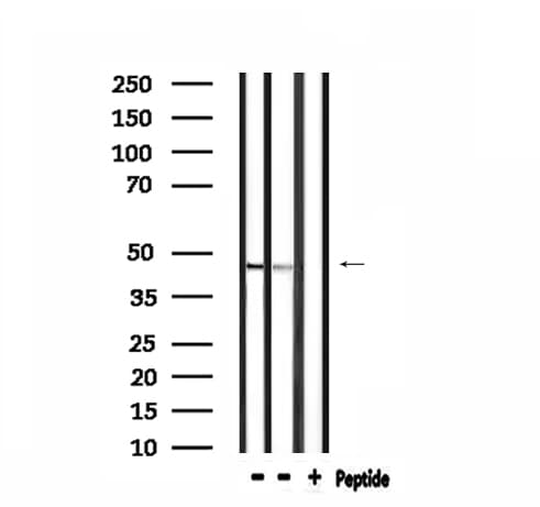 CADM2 Antibody