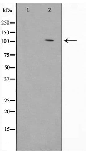 CDH1 / E Cadherin Antibody