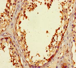 ZNF230 Antibody