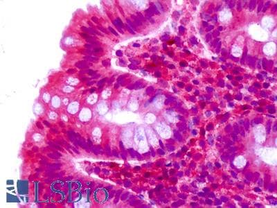 IHC-plus™ CELSR2 Antibody (C-Terminus)