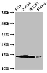 Polyclonal Rabbit anti-Human HIST1H3A Antibody (IHC, IF, WB)