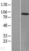 ZCCHC8 Protein (Over-Expression Lysate Myc-DDK (Flag))