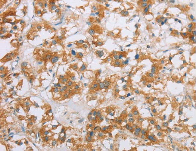 CYP2E1 Antibody