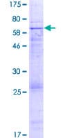 Human EPHX4 / Epoxide Hydrolase 4 Protein (Recombinant GST)