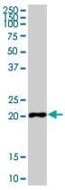 CYBA / p22phox Antibody (clone CS9)