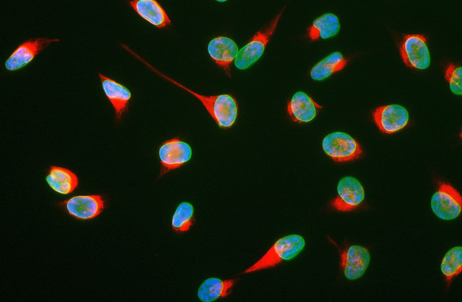 Vimentin Antibody