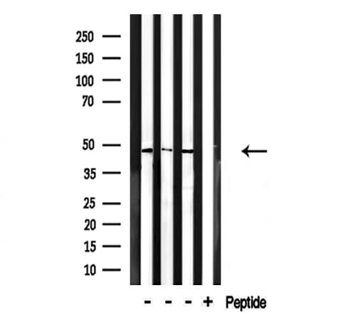 IGSF4C / CADM4 Antibody