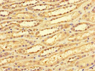 DACH / DACH1 Antibody
