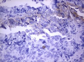 PIK3C2A Antibody (aa230-560, clone OTI2C2)