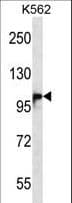 DSG1 / Desmoglein 1 Antibody (aa471-499)