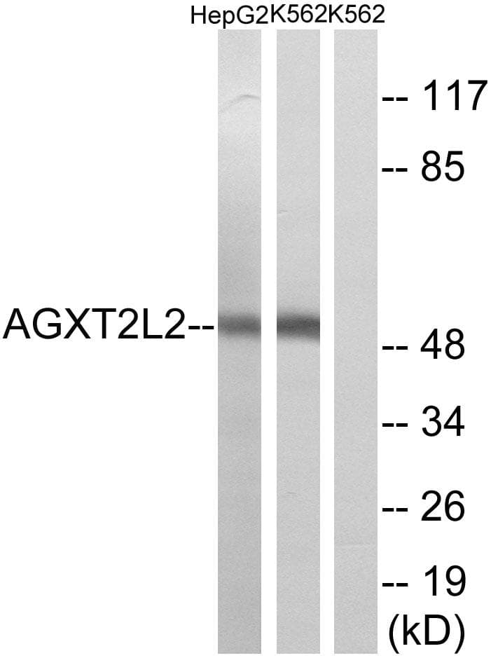PHYKPL / AGXT2L2 Antibody