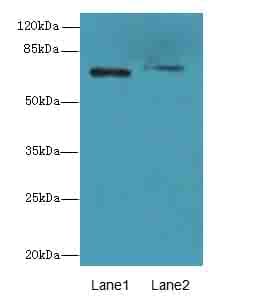 Polyclonal Rabbit anti-Human SLC6A6 / Taurine Transporter Antibody (IHC, WB)