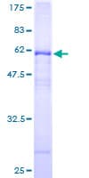 Human CA4 / Carbonic Anhydrase IV Protein (Recombinant GST)