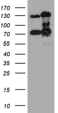 Monoclonal Mouse anti-Human RAD21 Antibody (clone OTI6C10, aa193-458, IHC, WB)