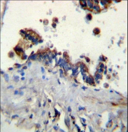 Polyclonal Rabbit anti-Human FCN3 / Ficolin-3 Antibody (aa214-243, IHC, WB)