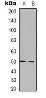 Polyclonal Rabbit anti-Human SERINC1 Antibody (C-Terminus, WB)