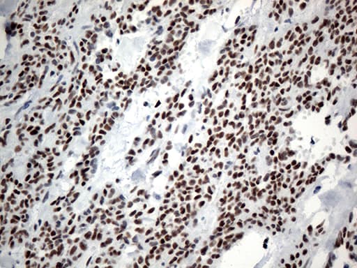 Monoclonal Mouse anti-Human GTF3C4 Antibody (clone OTI4A3, aa583-822, IHC, WB)
