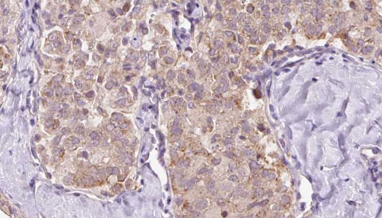 Polyclonal Rabbit anti-Human ZFYVE16 Antibody (IHC, IF, WB)
