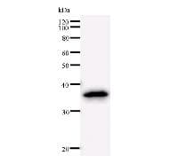 Monoclonal Mouse anti-Human SCML2 Antibody (clone SCMAD14A, WB)
