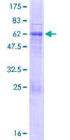Human UPK3B Protein (Recombinant GST)