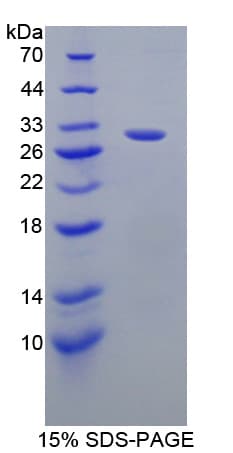 Mouse GAB2 Protein (Recombinant His-T7)
