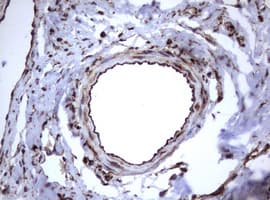 CD30 Antibody (clone OTI16H5)