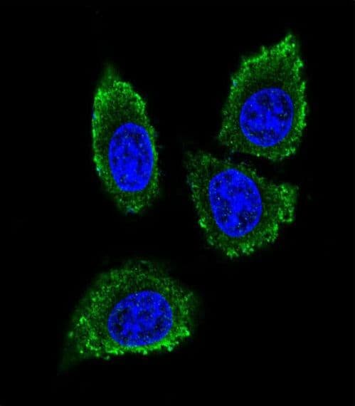MMP12 Antibody (aa391-420)