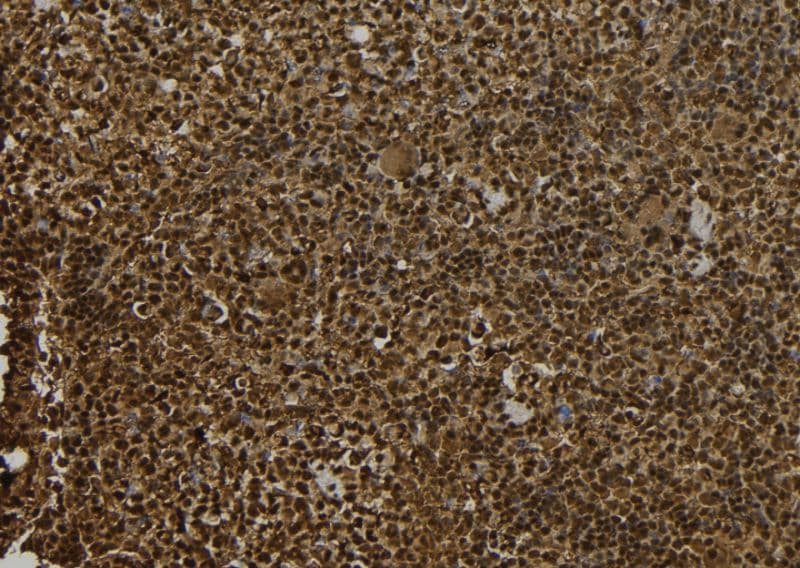 MAGEE1 Antibody