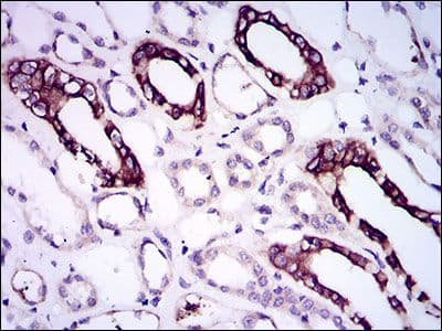 Monoclonal Mouse anti-Human ALK3 / BMPR1A Antibody (clone 4B7B2, Amino Acid: 179-378, IHC, WB)