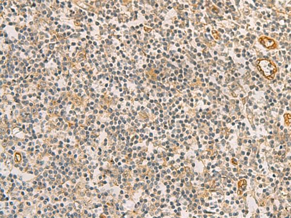 Polyclonal Rabbit anti-Human RAB13 Antibody (IHC)