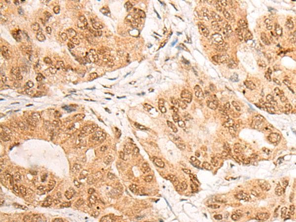 Polyclonal Rabbit anti-Human LPIN1 / Lipin 1 Antibody (IHC, WB)