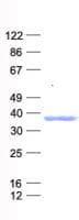 Human SNAI2 / SLUG Protein (Recombinant His, N-Terminal)