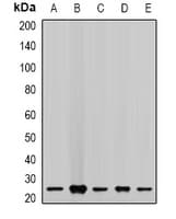 Polyclonal Rabbit anti-Human CHMP2B Antibody (IHC, IF, WB)