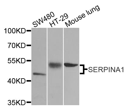 Polyclonal Rabbit anti-Human SERPINA1 / Alpha 1 Antitrypsin Antibody (IHC, IF, WB)