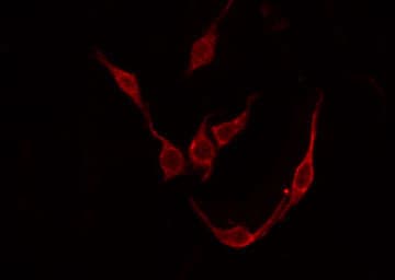 TACR3 / NK3R Antibody