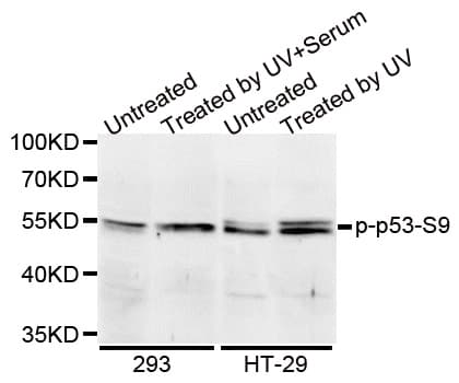 Polyclonal Rabbit anti-Human TP53 / p53 Antibody (phospho-Ser9, IF, WB)