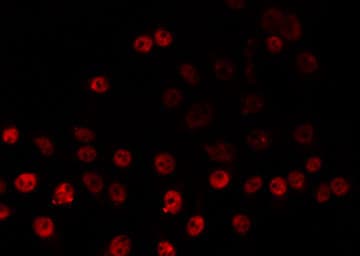 ZNF225 Antibody