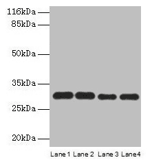 Polyclonal Rabbit anti-Human PMM1 Antibody (aa2-262, IHC, WB)