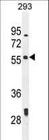 Polyclonal Rabbit anti-Human LARP6 / ACHN Antibody (aa7-35, IHC, WB)