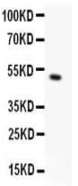 TRPC5 Antibody (aa684-973)
