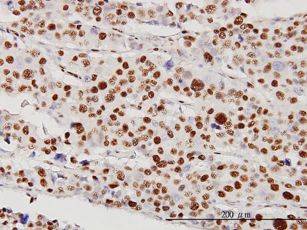 Monoclonal Mouse anti-Human STK38 Antibody (clone 2G8-1F3, IHC, IF, WB)