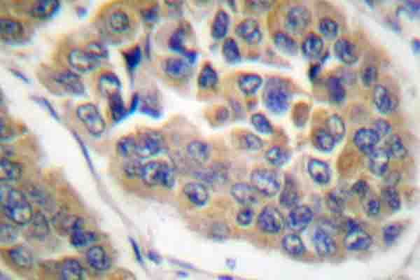 NR3C1/Glucocorticoid Receptor Antibody (phospho-Ser211)