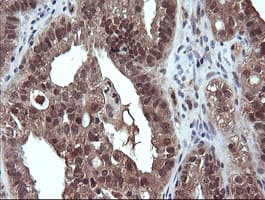 DDX58 / RIG-1 / RIG-I Antibody (clone OTI8D2)
