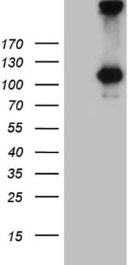 Monoclonal Mouse anti-Human IL20RA Antibody (clone OTI6F8, aa272-553, WB)