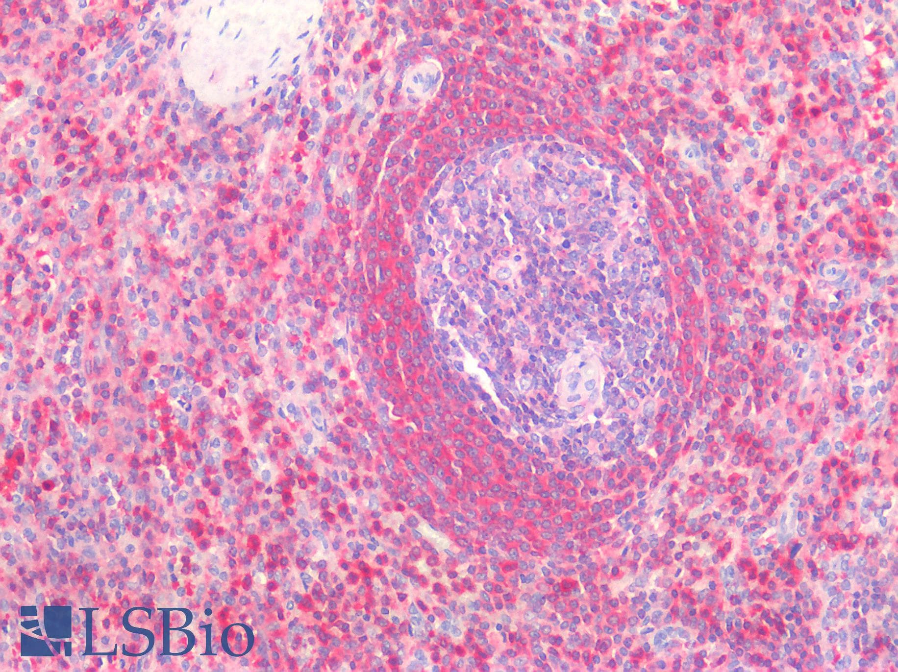 IHC-plus™ Monoclonal Mouse anti-Human G6PD Antibody (clone 2H7, IHC, WB)